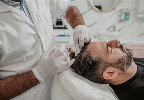 Haartransplantatie DHI: Wat Zijn De Voordelen?